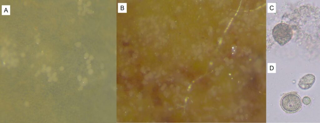 Figure 3: Caption: Symptomatic tomato tissue was placed in a dish and covered with water. Within 48 hours, Phytophthora sporangia began to grow profusely from the infected, symptomatic tissue. A) green tissue on the infected fruit, B) brown tissue on the infected fruit, both with significant amounts of sporangia. C) A sporangium floating in the water. It has a distinct pear-to-lemon shape. D) Oospores, the overwintering structure produced by Phytophthora, have a thick double wall and can develop in the infected plant tissue (bottom left structure) (Photo by John Bonkowski).